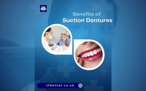Suction Dentures: A Comfortable Solution for Denture Wearers